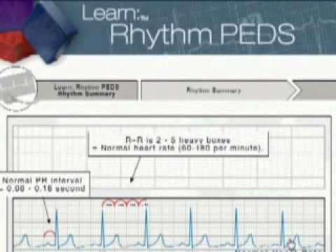 pals - http://www.surefirecpr.com Do you need to take a PALS class coming up? If so, take an American Heart Association online class to help you with ECG / EKG rhyt...