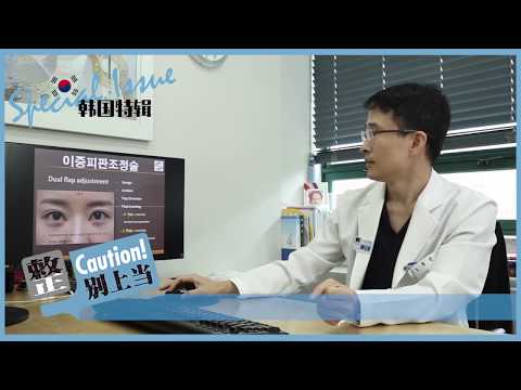 앞트임복원 수술전후 및 앞트임흉터 회복과정 (이중피판조정술)
