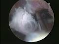 Foto v�deo