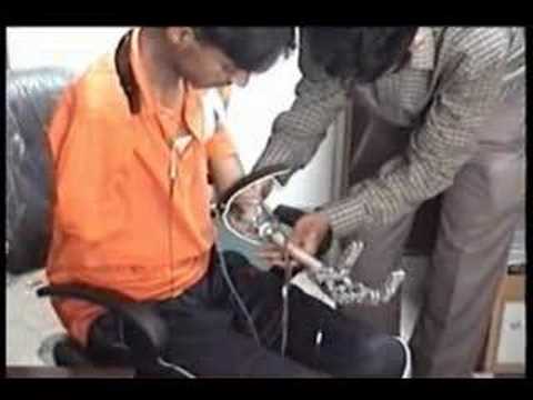 Myo-electric prosthetic upper limb