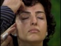 Cosmetic Acupuncture