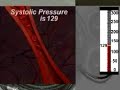 Blood Pressure