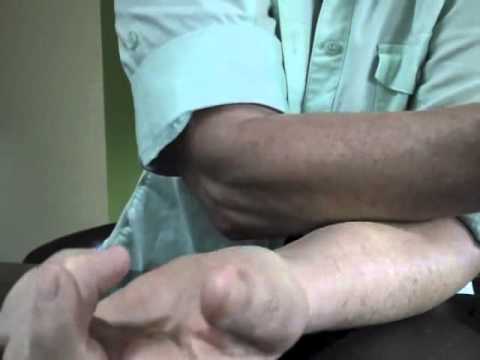 how to relieve forearm pain from typing