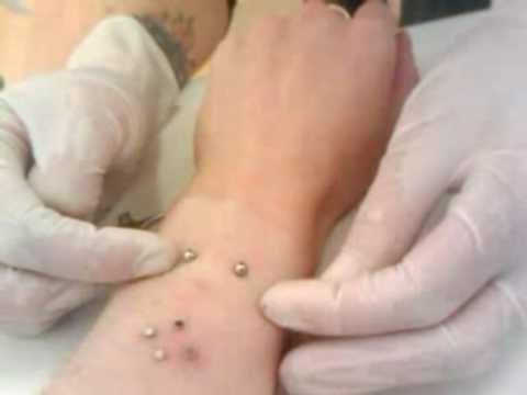 Wrist surface piercing with surface barbell. Performed at Volt in Grimsby.