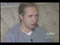 Stem Cell Treatment China Tyson McLain Friedreich's Ataxia