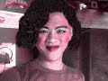 KARMAN SUCIWATI (SETELAH OPERASI PLASTIC) KARMAN SUCIWATI (SETELAH OPERASI PLASTIC)
