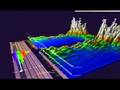 EEG Brainwaves Delta & Theta, right side dominant, Anand