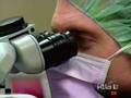 Fixes Your Keratoconus with Intacs and C3-R