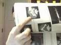 Skull Penetration of Cell Phone Radiation in Children