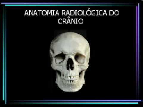 ANATOMIA DO CRÂNIO EM PORTUGUES ( caso não inicie click em atualizar a página)