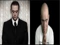 L.O.C Superbia (Kato Remix) (Radio Edit)