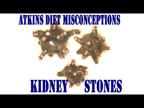 how to dissolve existing kidney stones