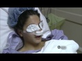 Teen Plastic Surgery