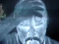FLIR thermal infrared camera: rings on forehead