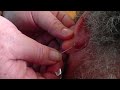 Big zit