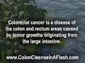 Colon Cancer - Early Symptoms