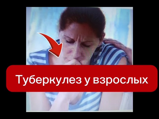 Туберкулез у Взрослых