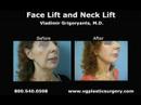 Los Angeles Face Neck lift by Dr. Vladimir Grigoryants Los Angeles Face Neck lift by Dr. Vladimir Grigoryants