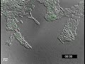 Pseudomonas aeruginosa twitching motility YFP-PilU