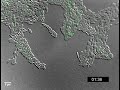 Pseudomonas aeruginosa twitching motility YFP-PilU Pseudomonas aeruginosa twitching motility YFP-PilU