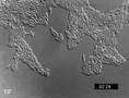Pseudomonas aeruginosa twitching motility YFP-PilU