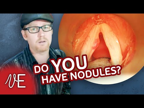how to cure vocal nodules