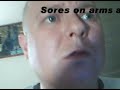 Video evidence of disease afflicting me Video evidence of disease afflicting me