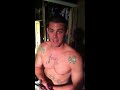 Removing kj's cyst!!!