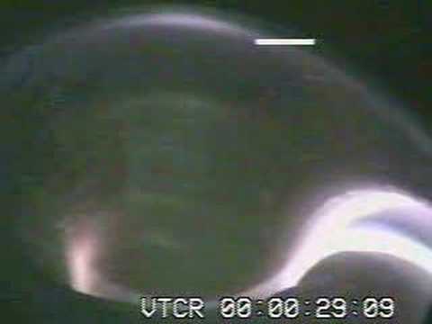 JET Plasma