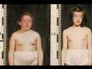 Anabolic Steroids (Health Project)