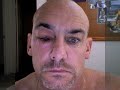Nick v a Bee