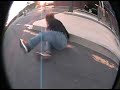 cjs concussion cjs concussion