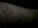 11 Days later