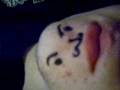 CHIN FACE