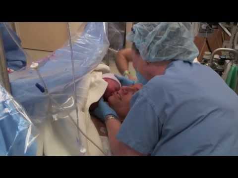 how to perform c-section delivery