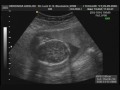 5 meses!!!! uauuuu metade do caminho!