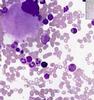 Shotgun Histology Bone Marrow Smear
