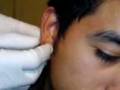 Expansor Mike