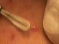 ZITS