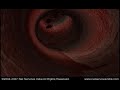 3D Stent Implant Animation. All Rights Reserved By Lancer Medical Technology Pvt. Ltd. Visit: www.lancermedicaltechnlogy.com Animation Developed By Net Services India