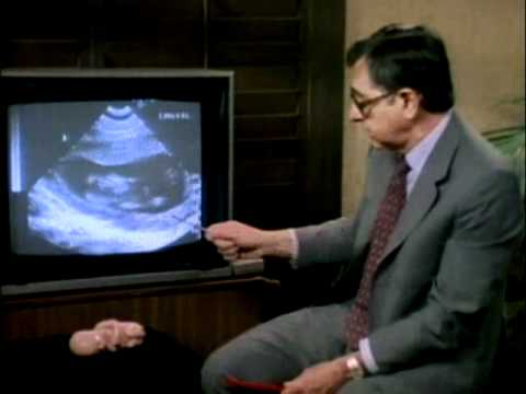 how to decide to keep a baby or abort