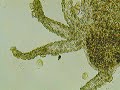 Trichodina