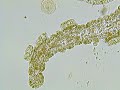 Trichodina