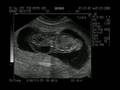 Nugget at 11wks