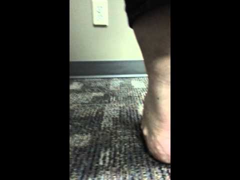 how to rebuild arches in flat feet