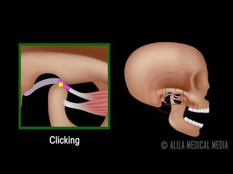 how to treat tmj dislocation