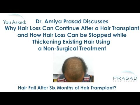 how to reduce swelling after hair transplant