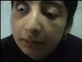 inspection of sclera for jaundice