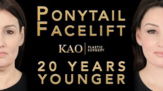 Amazing Transformation - Ponytail Facelift™ Before and After - KAO Plastic Surgery Before and After