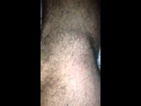 how to isolate semimembranosus